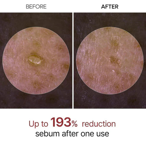 final-3-hours-42-off-gentle-exfoliator-glow-rice-ampoule-suitable-for-all-skin-types-1448